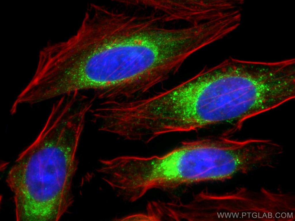 Calumenin Polyclonal antibody