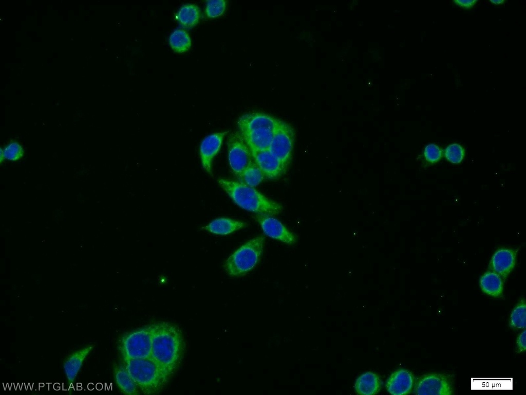 PRPSAP2 Polyclonal antibody