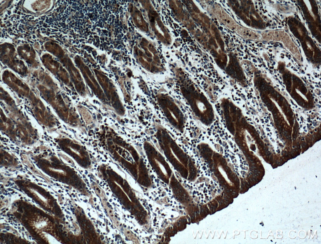 RAB27A Polyclonal antibody