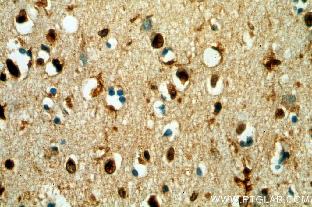 TCEA1 Polyclonal antibody