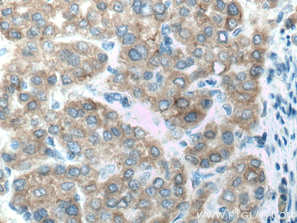 CYP2D6/7 Polyclonal antibody