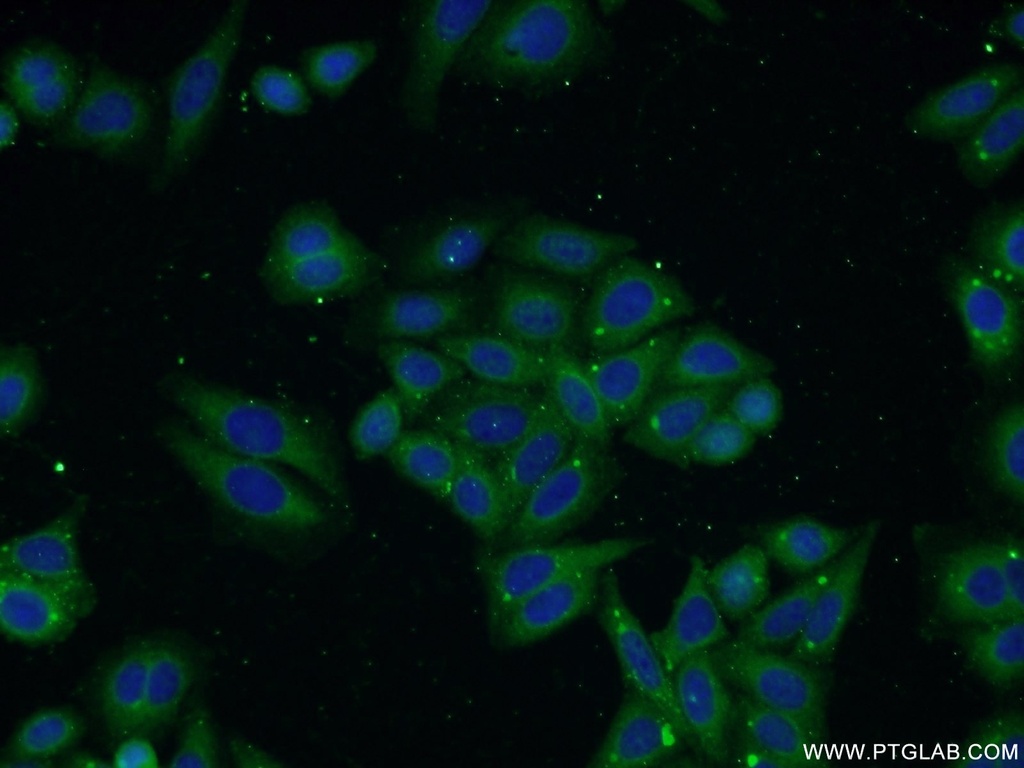 TP53INP1 Polyclonal antibody