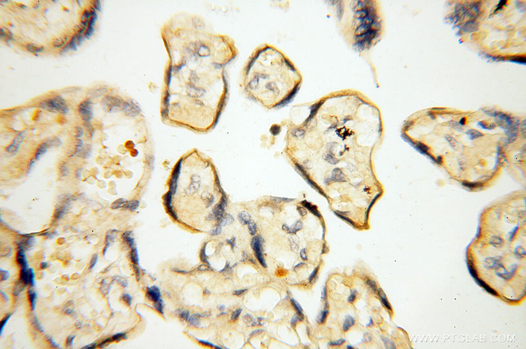 MMP8 Polyclonal antibody