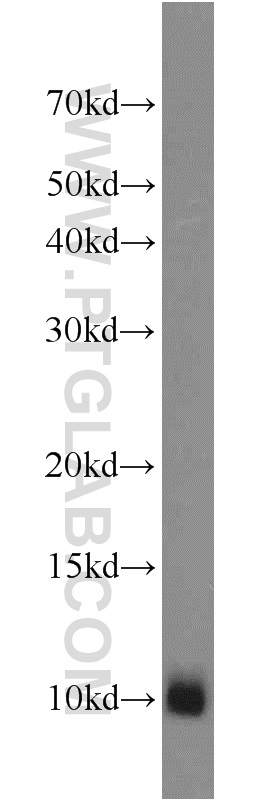 MPV17L Polyclonal antibody