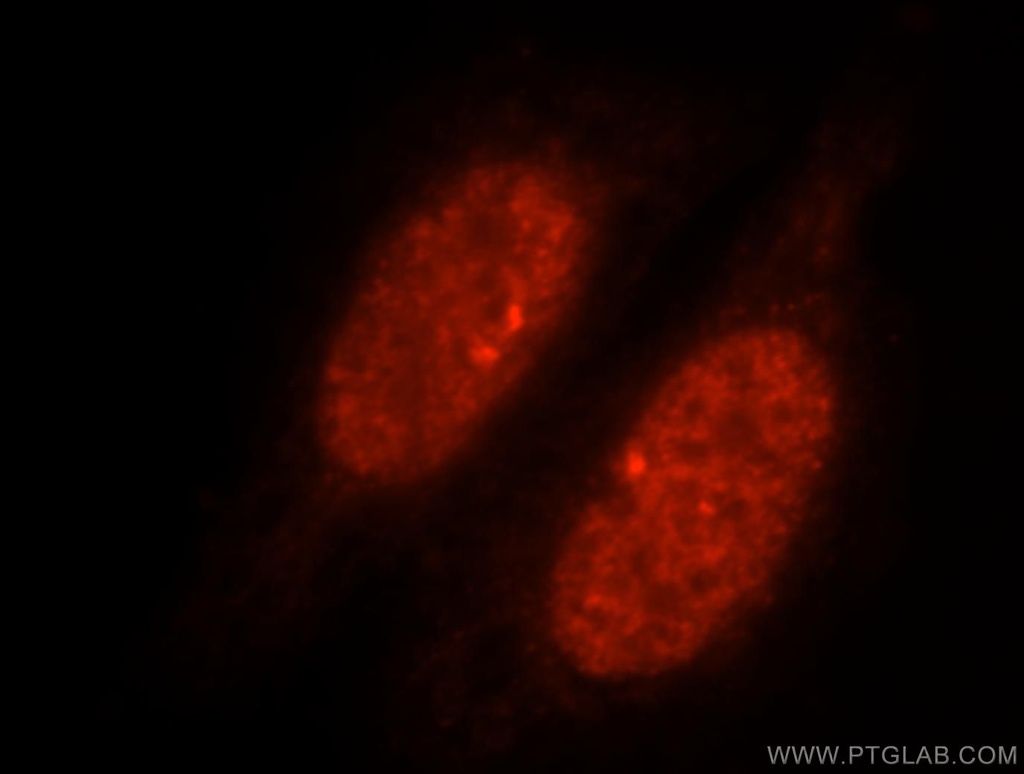 SLTM Polyclonal antibody