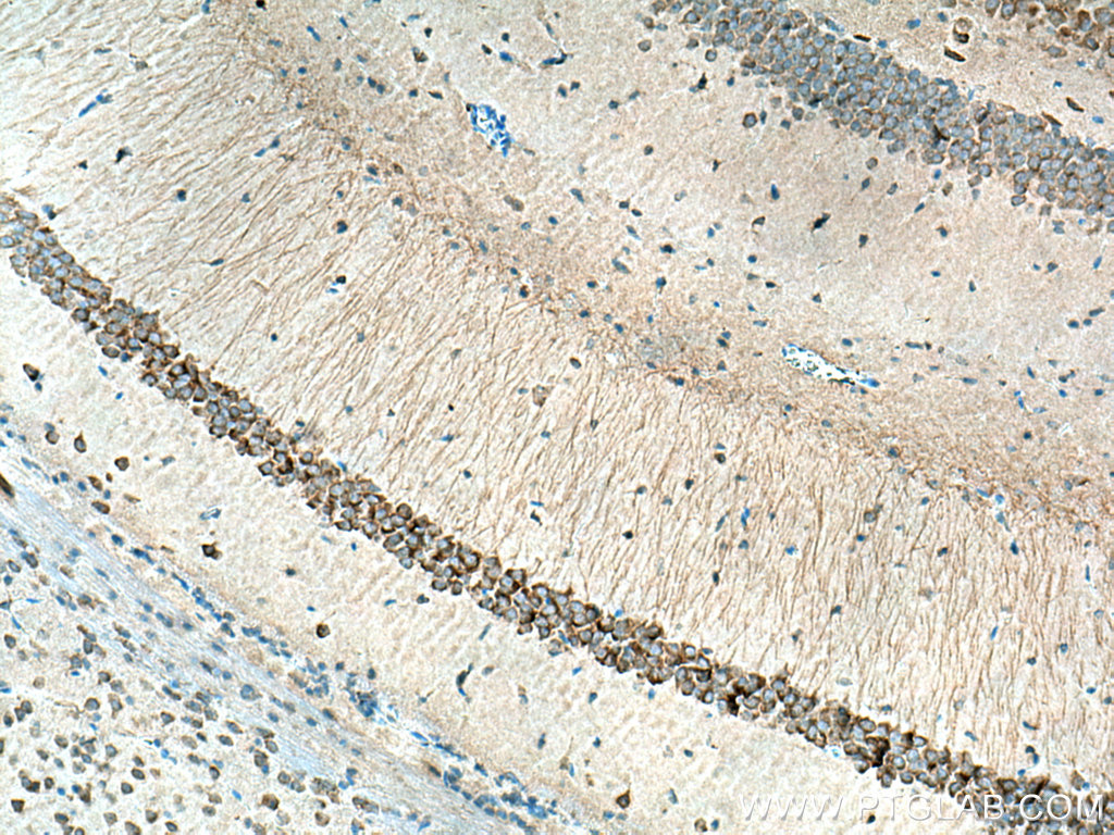 KCNAB2 Polyclonal antibody