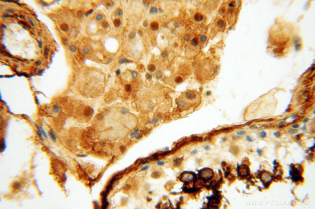 CTTNBP2 Polyclonal antibody
