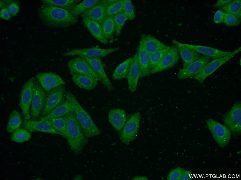 S100A5 Polyclonal antibody
