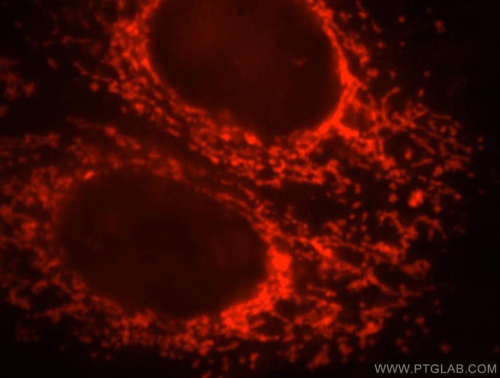 ETFB Polyclonal antibody