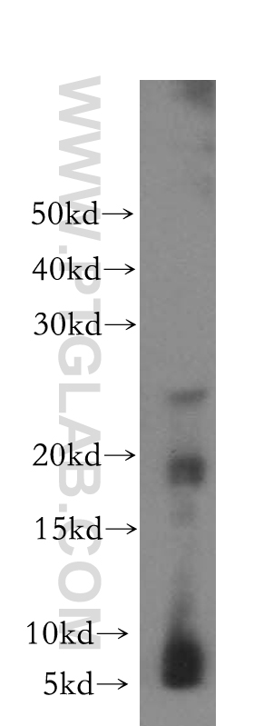 CRYGC Polyclonal antibody
