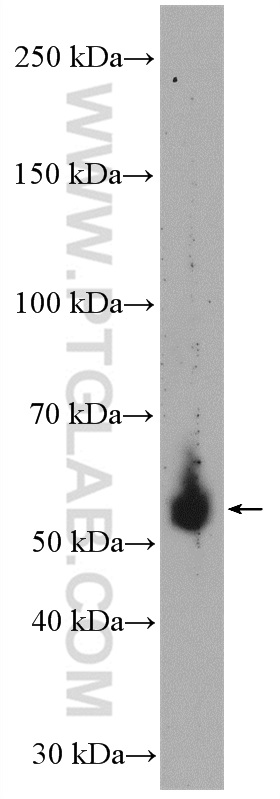 HFE Polyclonal antibody