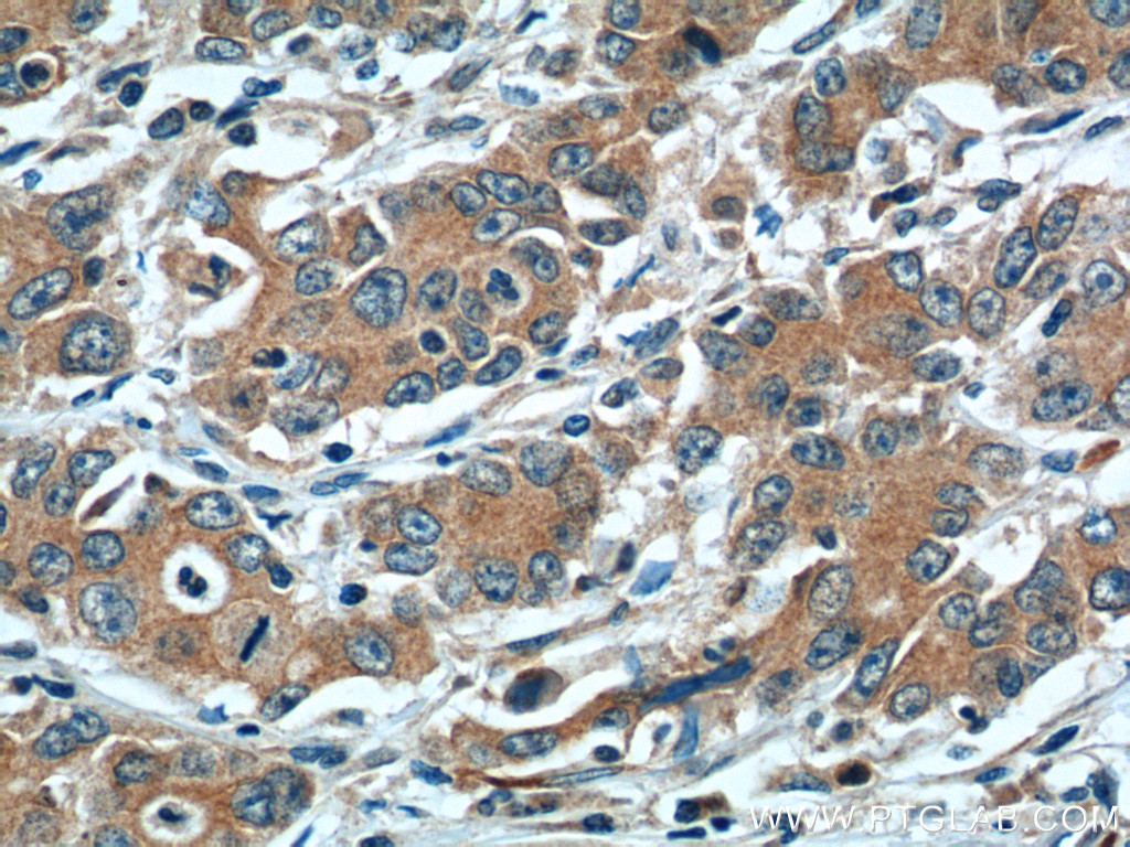 LOX Polyclonal antibody