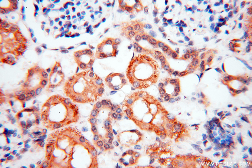 BPHL Polyclonal antibody