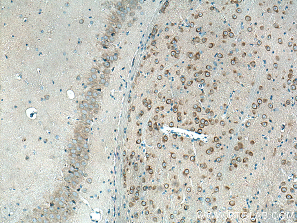 REEP1 Polyclonal antibody