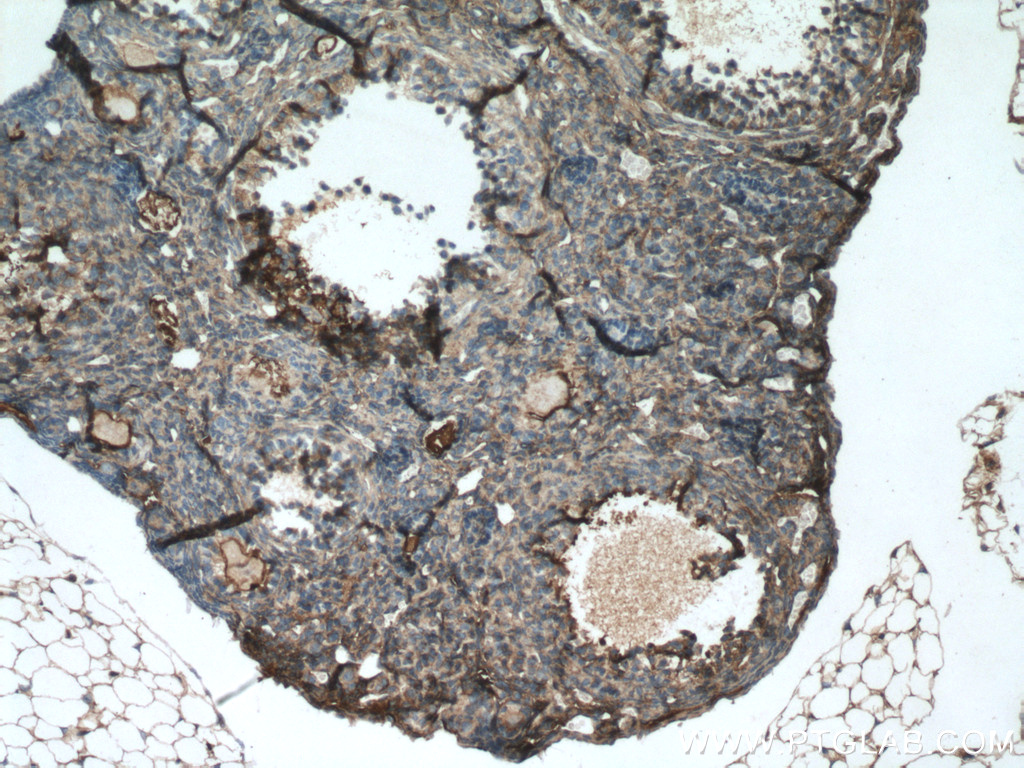AANAT Polyclonal antibody