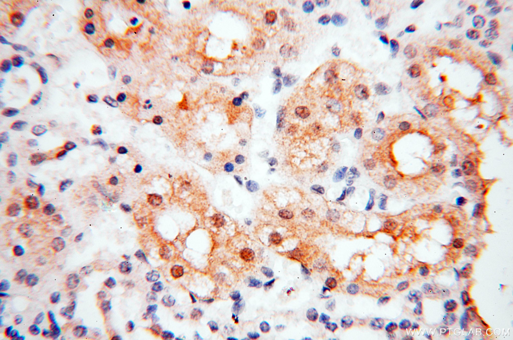 PPCS Polyclonal antibody