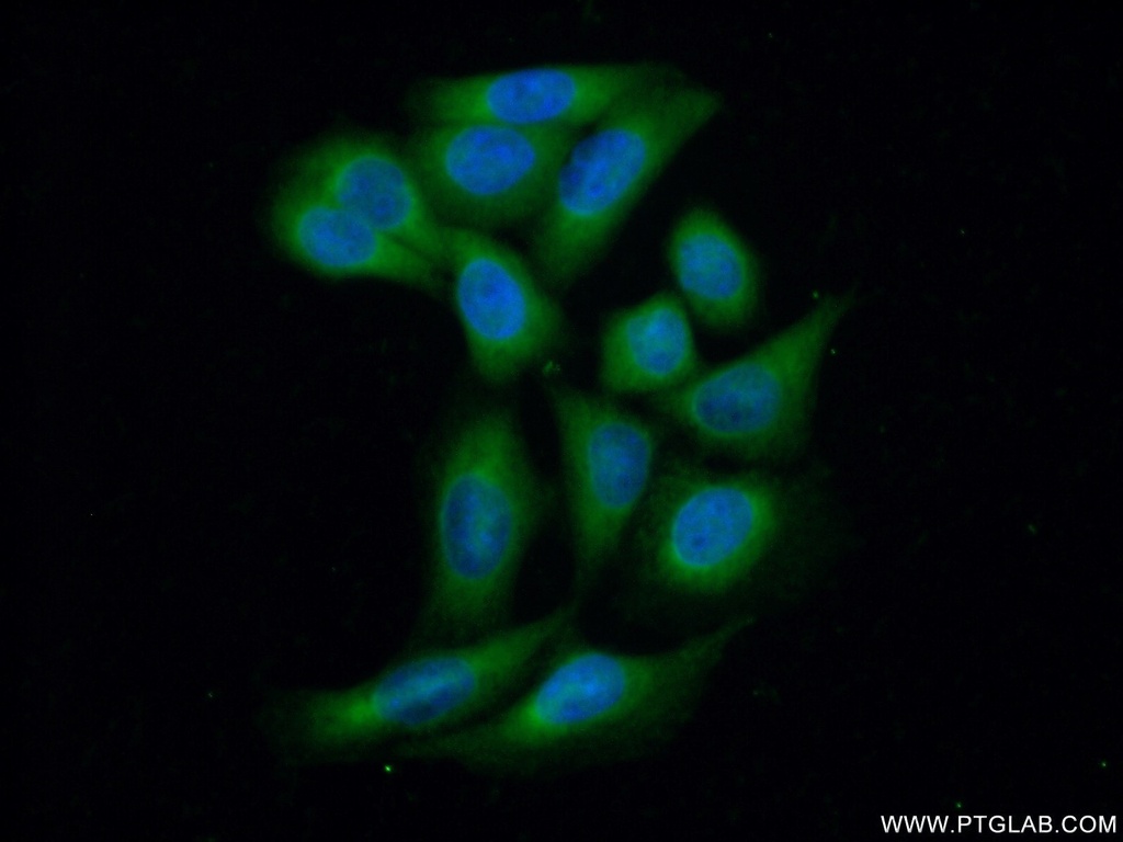 PP11 Polyclonal antibody