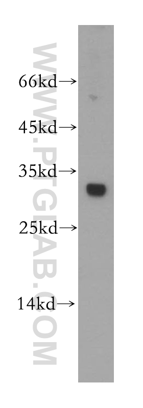 Nucleoside phosphorylase Polyclonal antibody