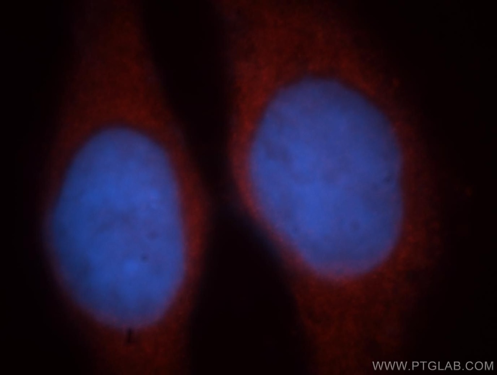 EIF2B1 Polyclonal antibody