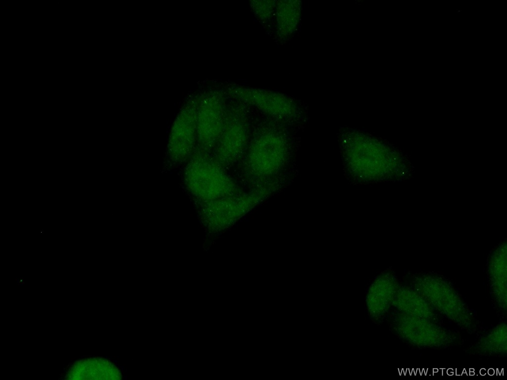 PLAG1 Polyclonal antibody