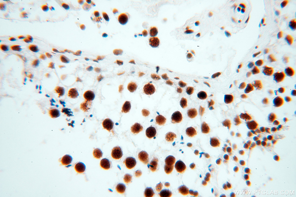 SART3 Polyclonal antibody