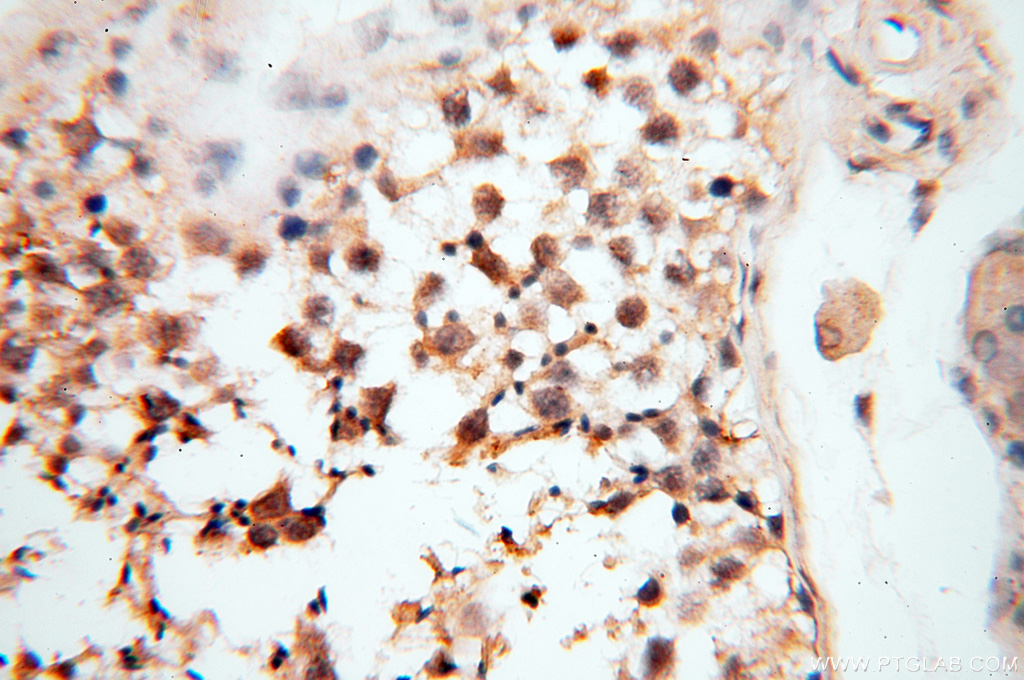 CARD6 Polyclonal antibody