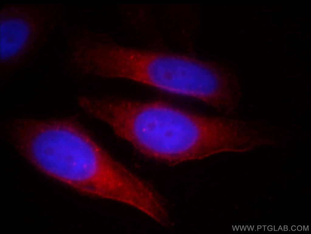 TNKS Polyclonal antibody