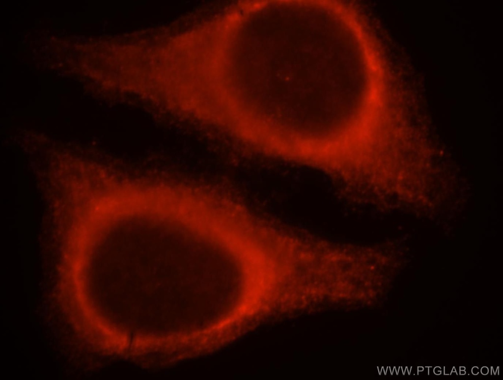 SERPINB13 Polyclonal antibody