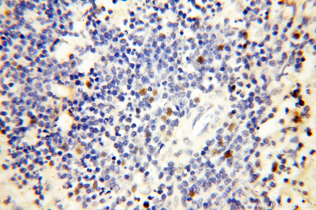 DNA Ligase I Polyclonal antibody
