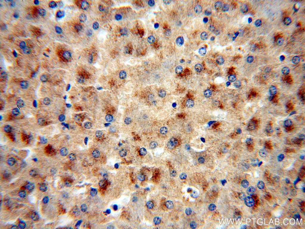 fetuin-B Polyclonal antibody
