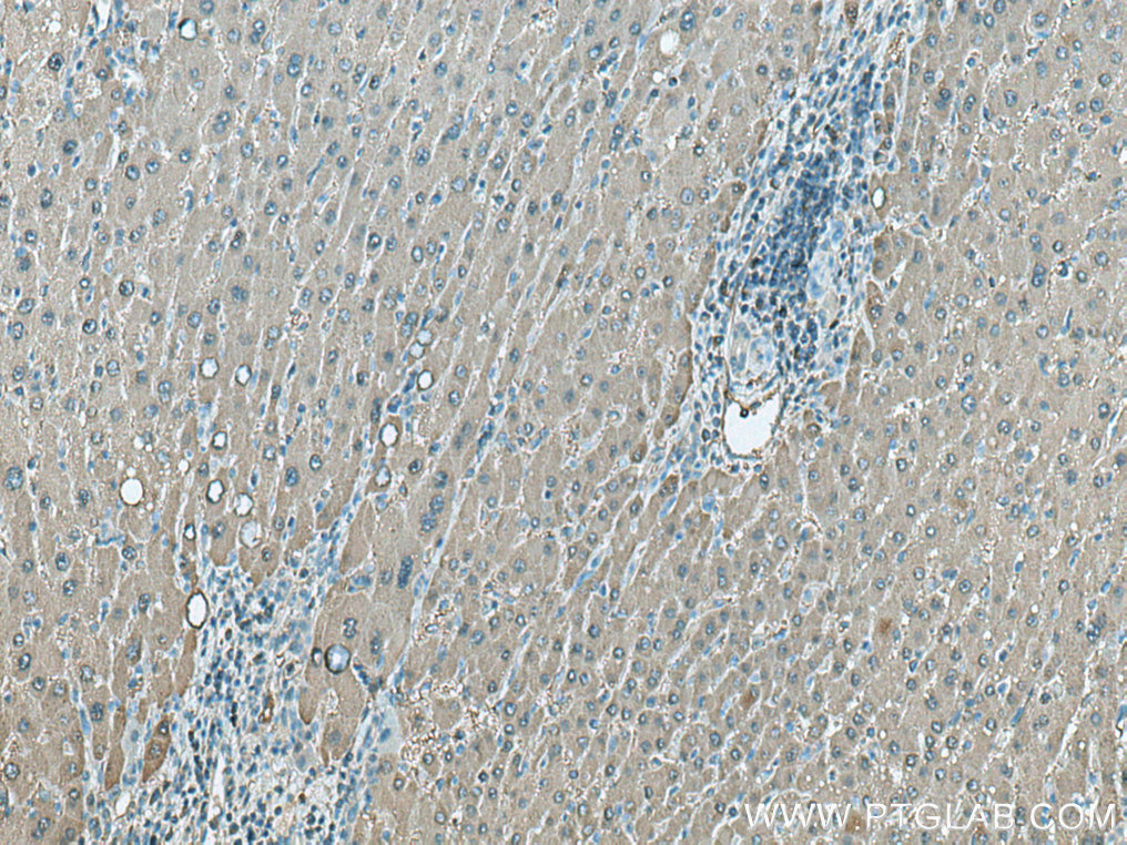 ALDOB Polyclonal antibody