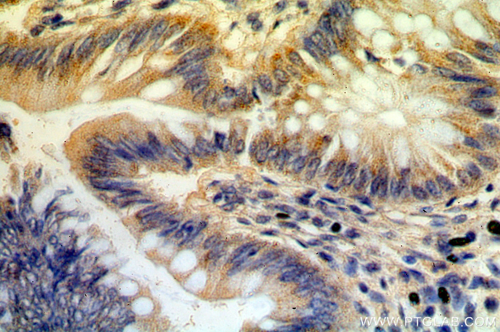 B3GNT3 Polyclonal antibody