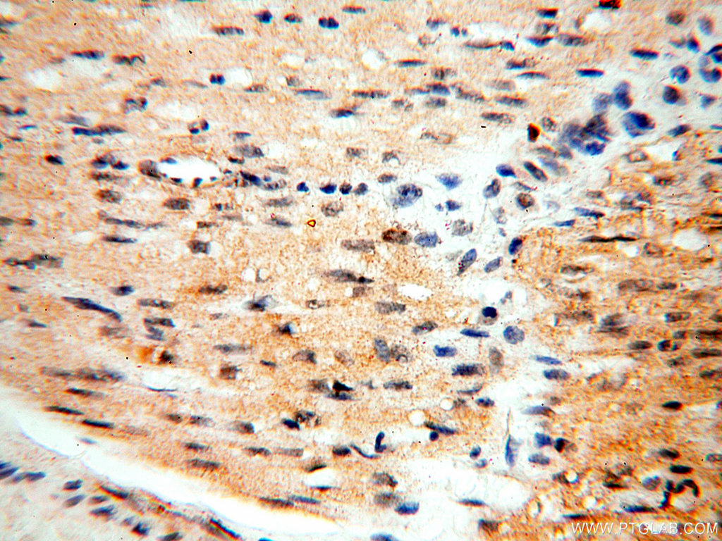 SGCG Polyclonal antibody