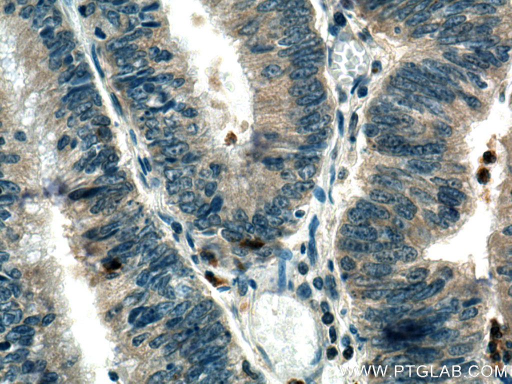 TRAF3IP3 Polyclonal antibody