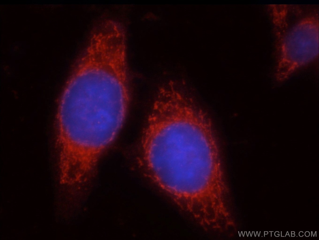 Uroguanylin Polyclonal antibody