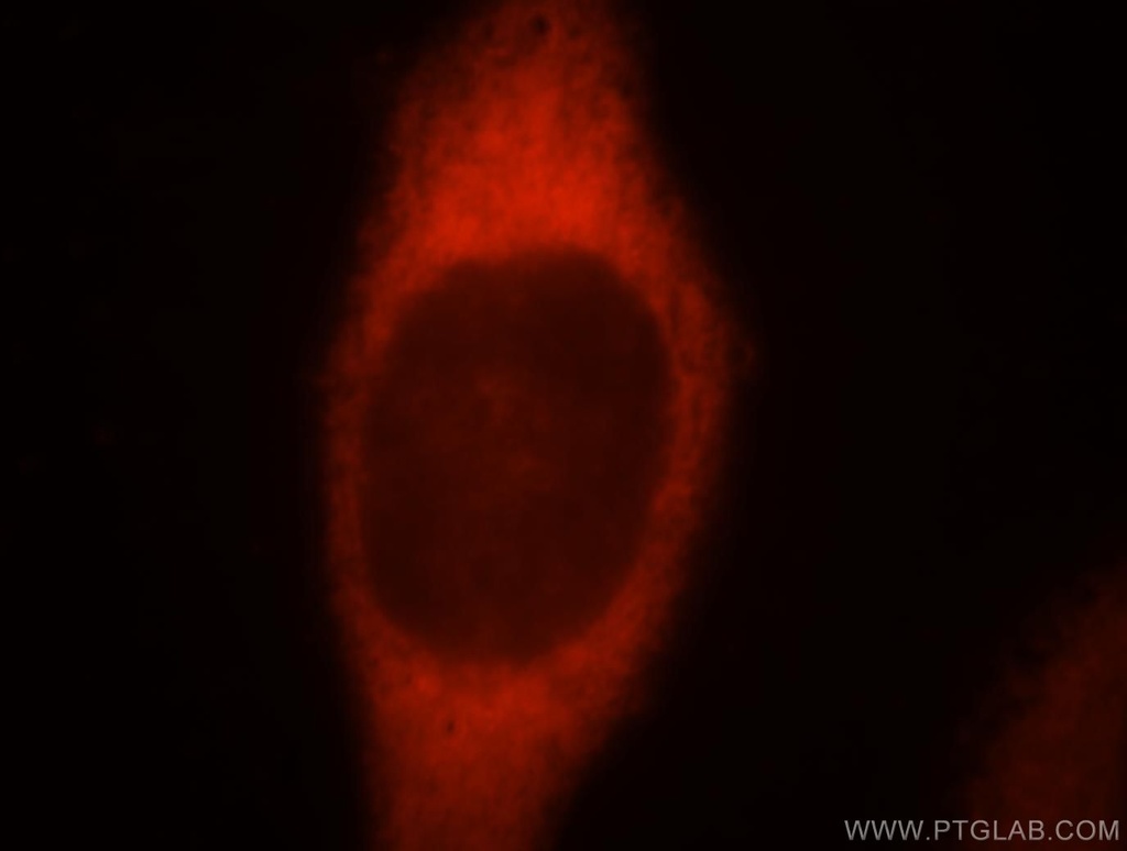 FARSA Polyclonal antibody