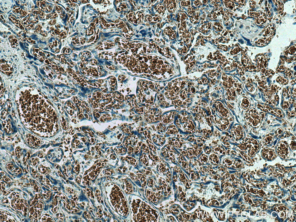 GYPC Polyclonal antibody