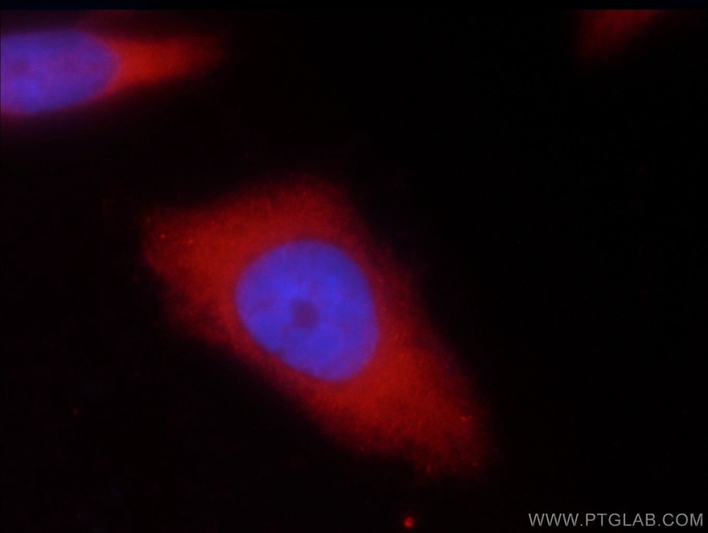 UBE4B Polyclonal antibody