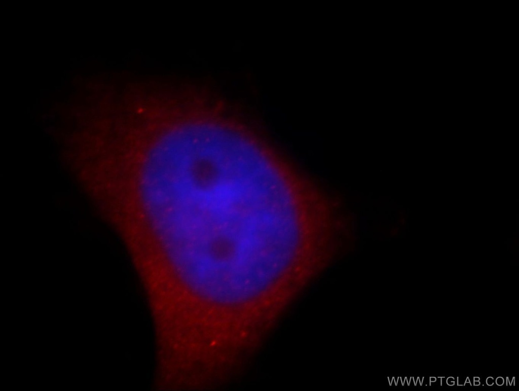 NPTX1 Polyclonal antibody