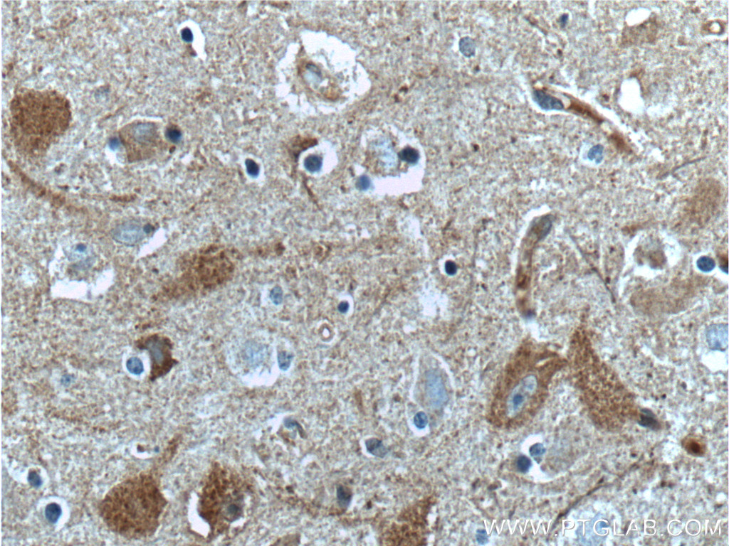 CaMKII delta-Specific Polyclonal antibody