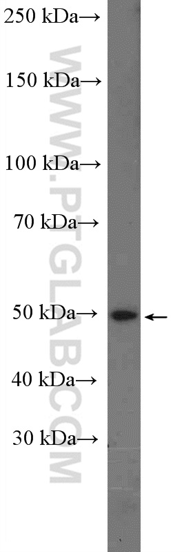 SLC16A2 Polyclonal antibody