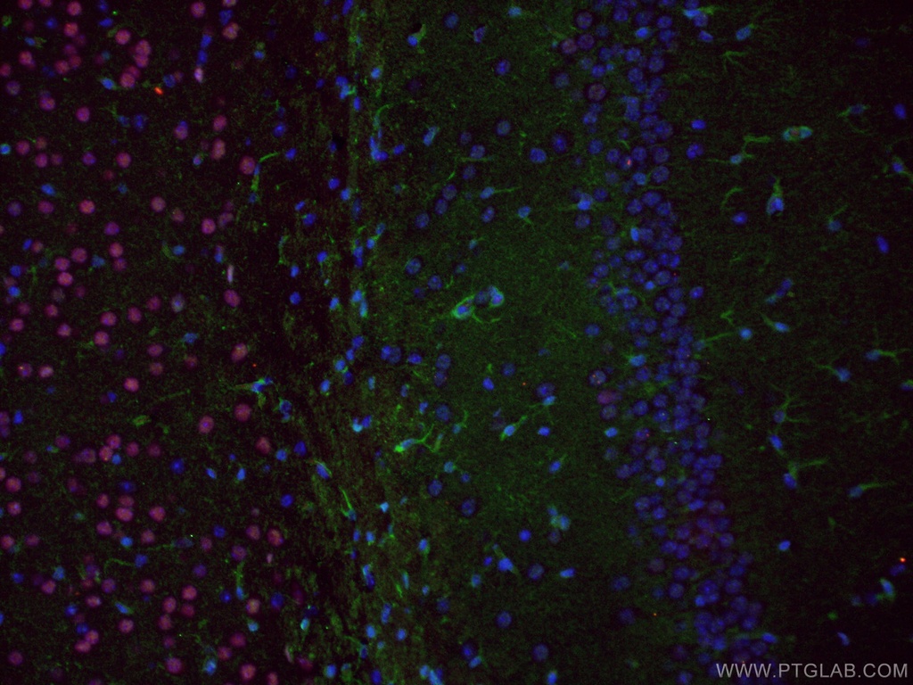 RELN Polyclonal antibody