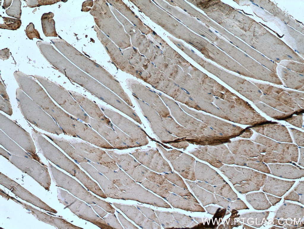 IRS2 Polyclonal antibody