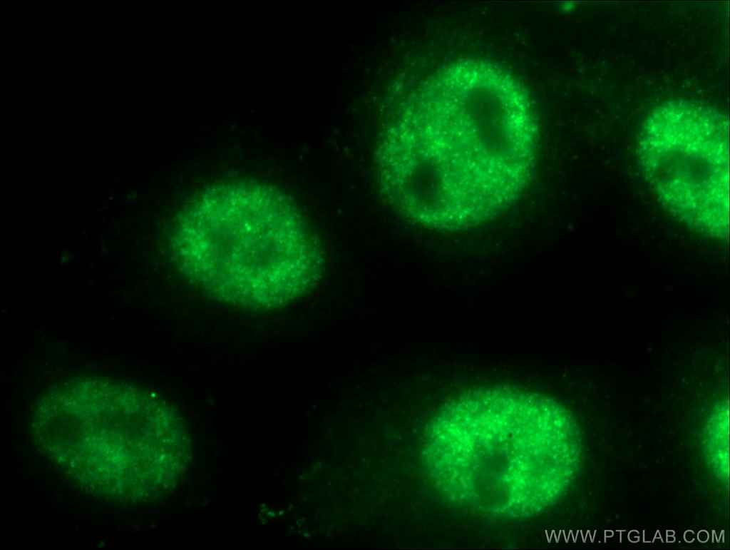 TOP1 Polyclonal antibody