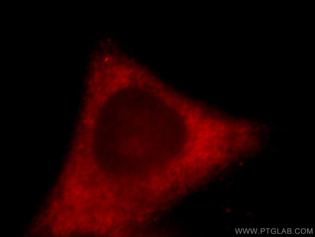 ACSL3 Polyclonal antibody