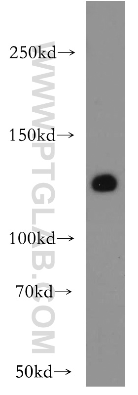 VEGFR3 Polyclonal antibody