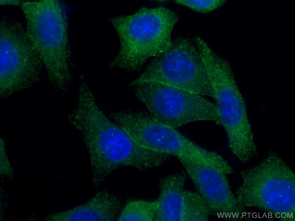GHR Polyclonal antibody