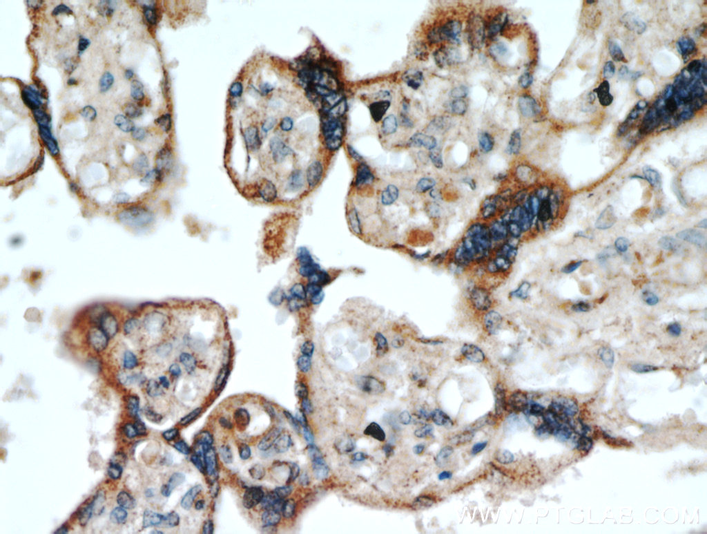 TMC1 Polyclonal antibody