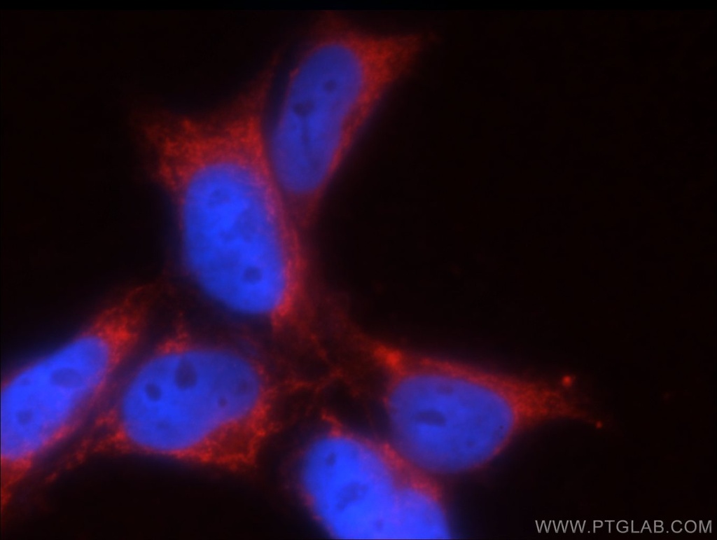 GNRHR2 Polyclonal antibody