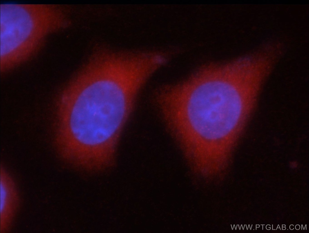 GAD65 Polyclonal antibody